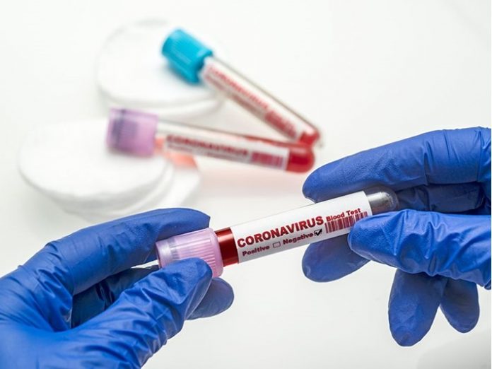 181D3EB2-8F46-4DAA-AD7D-8DB4C7C08801