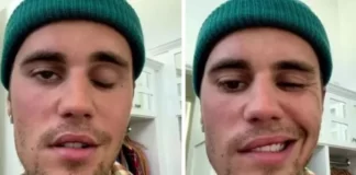 Justin Bieber Yüz Felci Geçirdi!