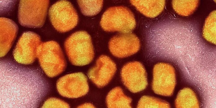 Maymun Çiçeği Virüsü Şimdi de Letonya'da!