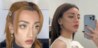 Mika Raun kalça ve göğüs yaptırdı!